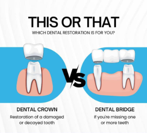 dental crowns and bridges