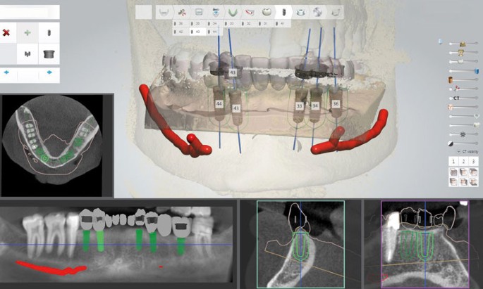 digital dentistry