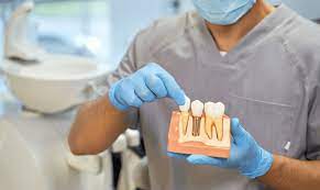 dental veneers in pragathi nagar