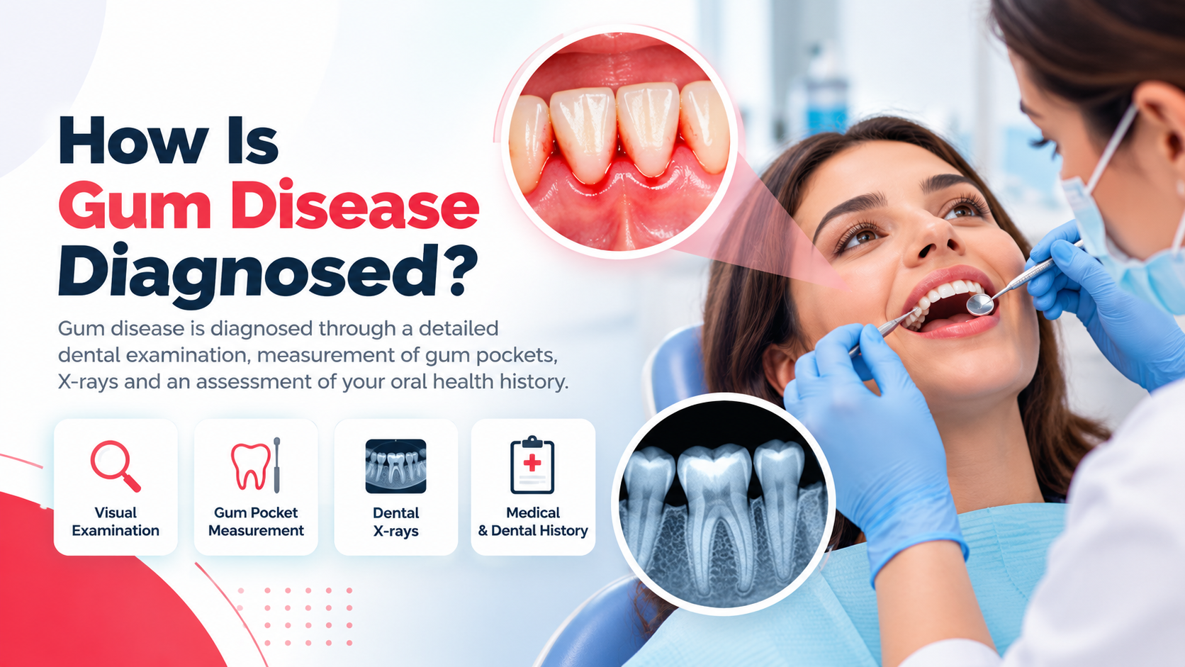 bleeding gums