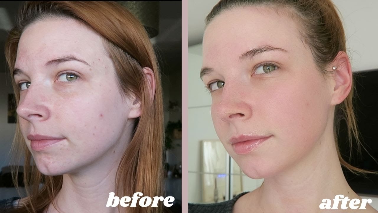 facial
