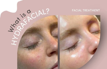 Hydrafacial