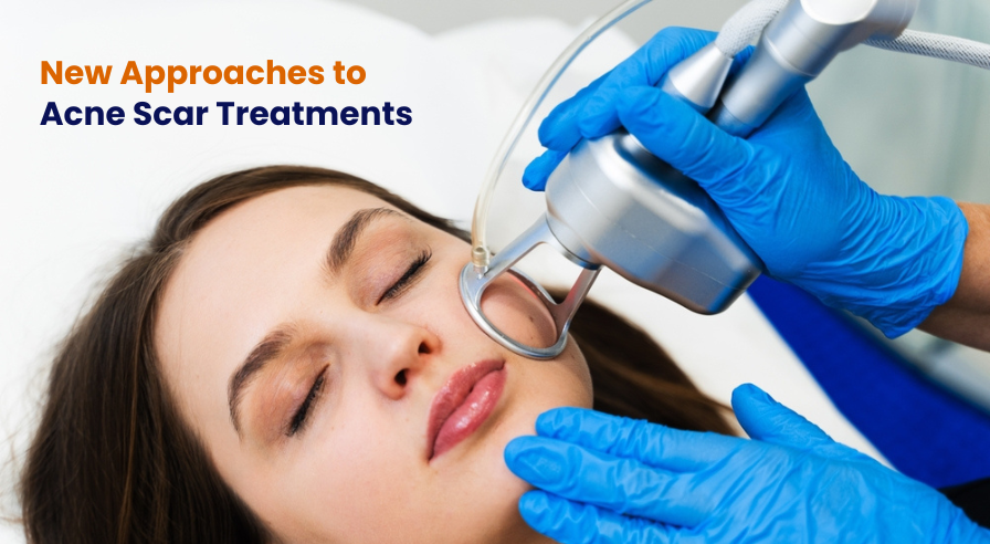 dental veneers in pragathi nagar