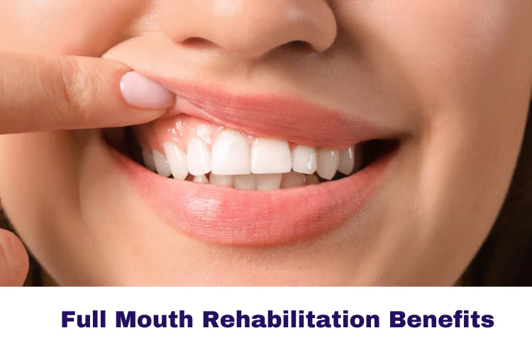 full mouth rehabilitation