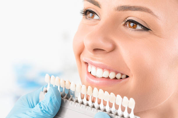 dental veneers in pragathi nagar