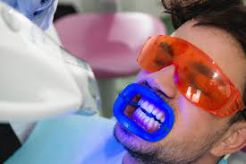 dental veneers in pragathi nagar