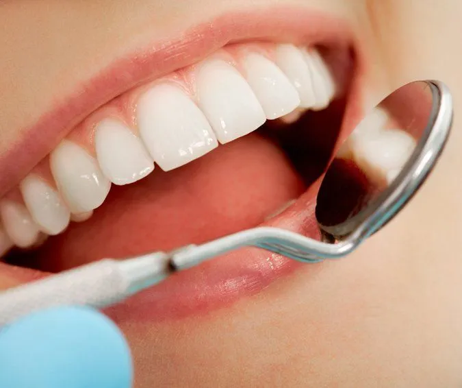 dental veneers in pragathi nagar