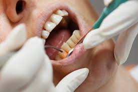 Laser-Gum-Disease-Treatment