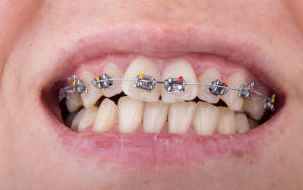 dental implant clinic